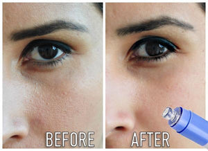 Electric Facial Pore Cleanser - Feminess