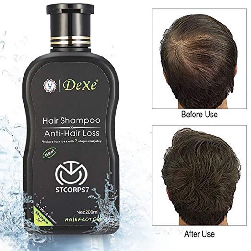 Anti-Hair Loss Shampoo - Feminess