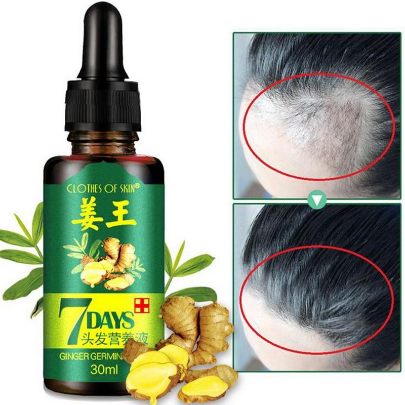 Hair Growth Serum For Women - Feminess